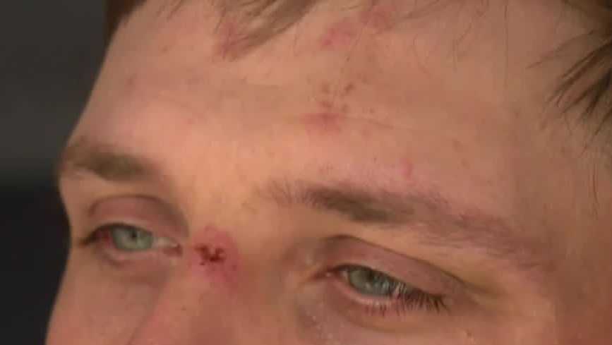 Tow truck drivers describe being beaten, pistol-whipped during 'all-out brawl' after A-Day game