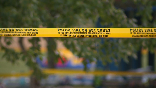 Police: 17-year-old hospitalized after being grazed by bullet in leg ...