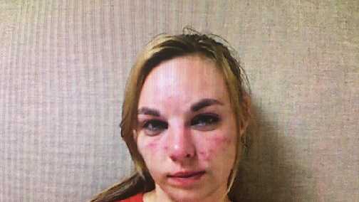 Woman charged with DWI after utility pole crash