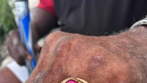 Super Bowl ring found 40 years after lost in ocean off Waikiki