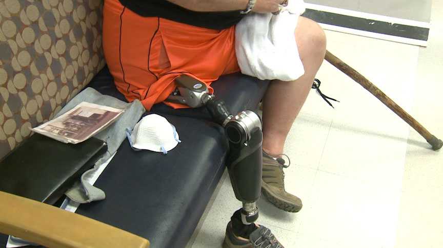 Flowood enterprise introduces slicing edge technological know-how for people in require of prosthetics