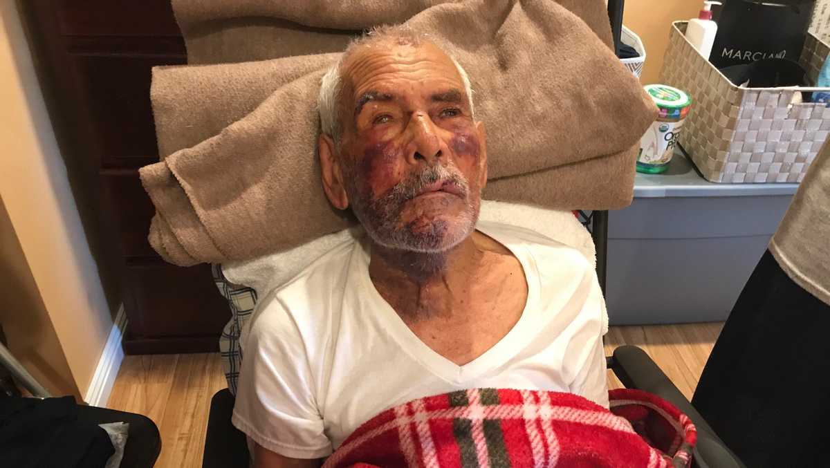 Woman Arrested In Case Of 91 Year Old Man Beaten With Brick Told Go