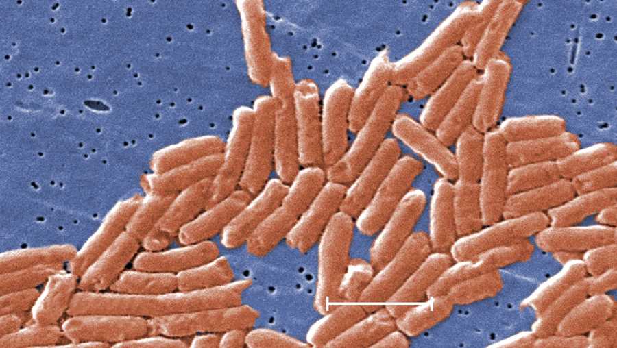 A deadly strain of salmonella that has sickened more than 250 people may not respond to the antibiotics commonly prescribed to treat the foodborne infection, according to the US Centers for Disease Control and Prevention.