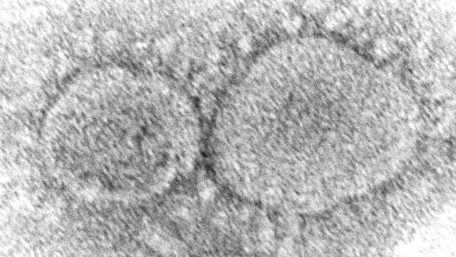Doctor explains study comparing COVID-19 to preexisting viruses 
