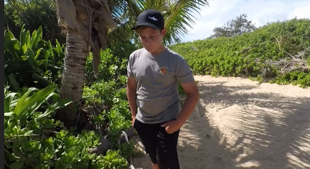 Less Than A Week After Shark Bite, Teen Ready To Surf Again