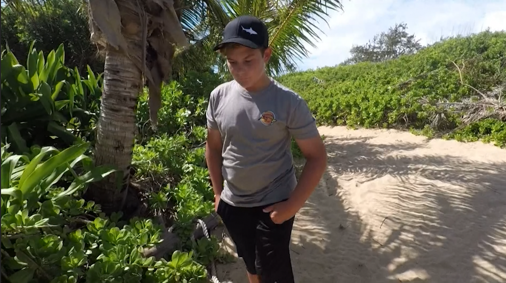 Less than a week after shark bite, teen ready to surf again - Vimarsana News