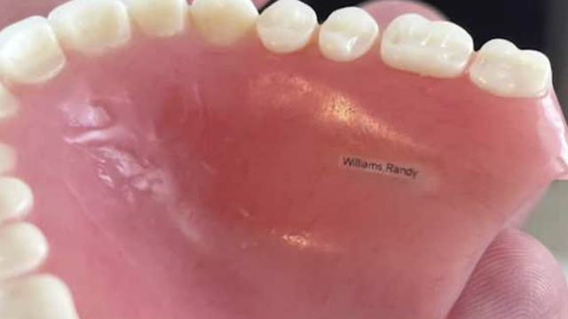 Mississippi man finds dentures while snorkeling in Gulf Shores - Vimarsana News