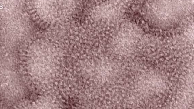 Doctors brace for peak of flu season - Vimarsana News