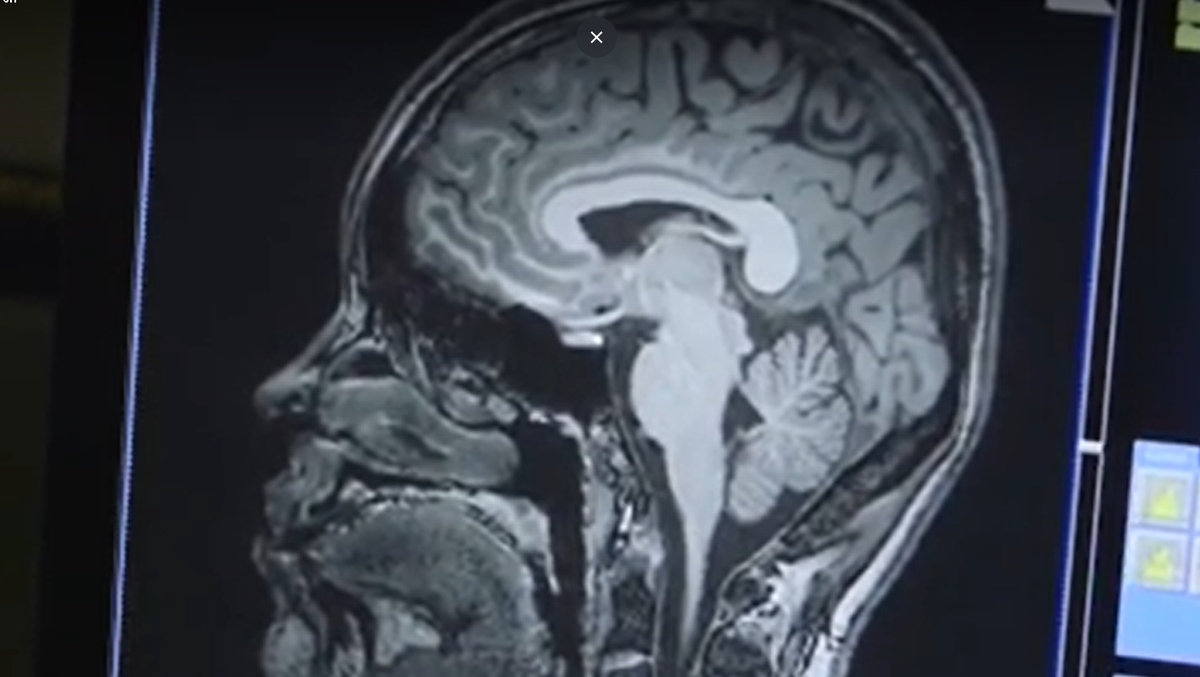 Universities team up on brain and behavioral research