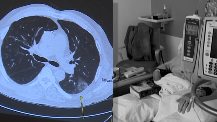 Cancer survival rates reach new milestone in the U.S.