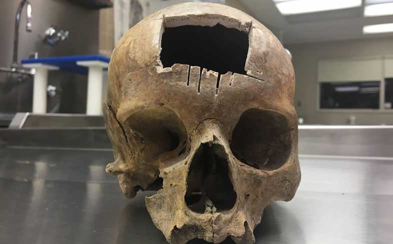 skull-1519788086.jpg?crop=1.
