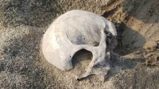 Iowa sisters find human skull in Des Moines River - Vimarsana News