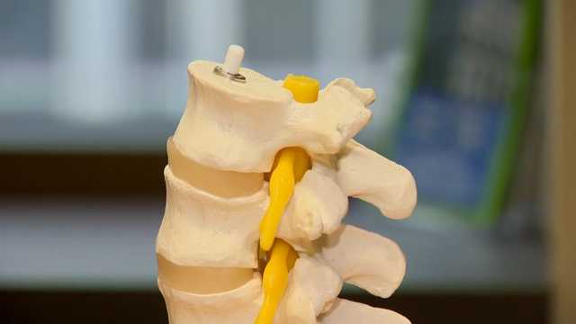 When spinal stenosis may require surgery - Vimarsana News