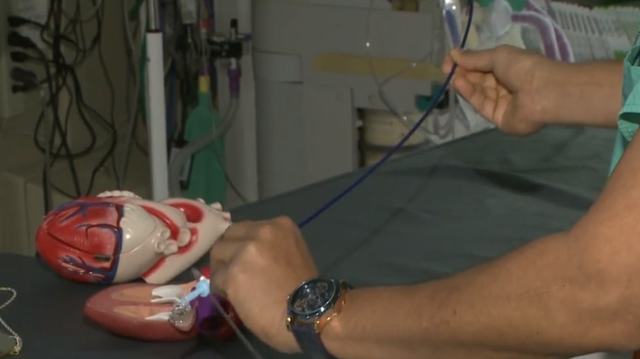 First of its kind operation performed at CHI Health Bergan Mercy