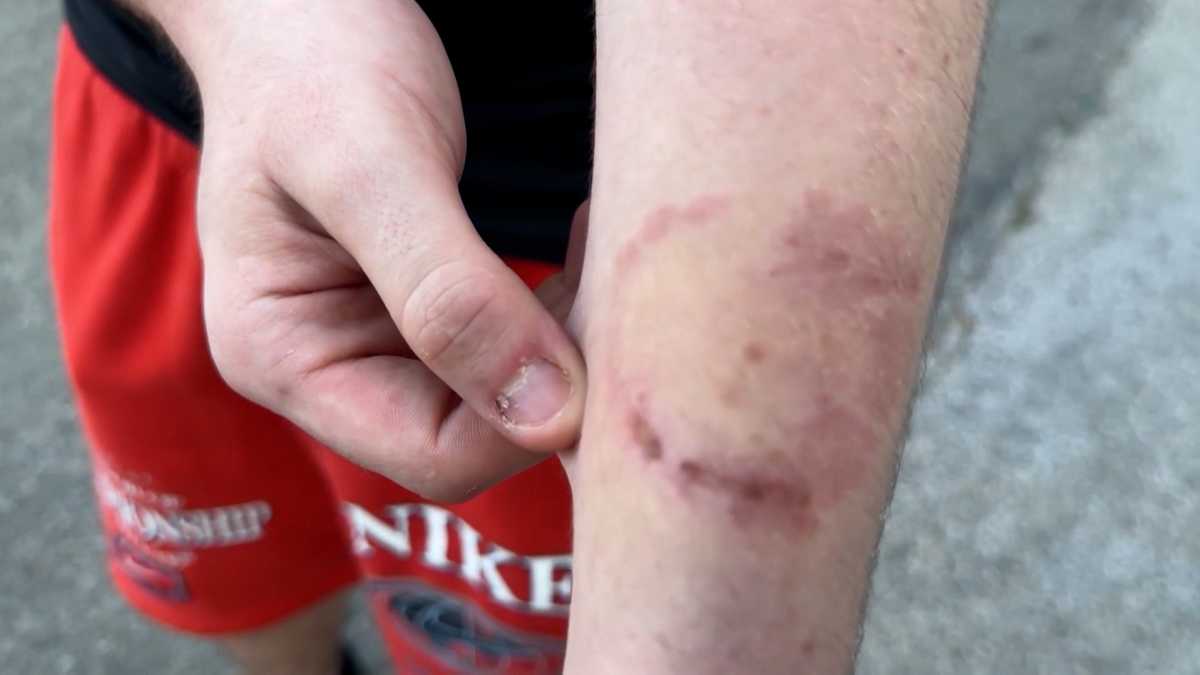 Police search for man accused of biting teen at New England Dragway