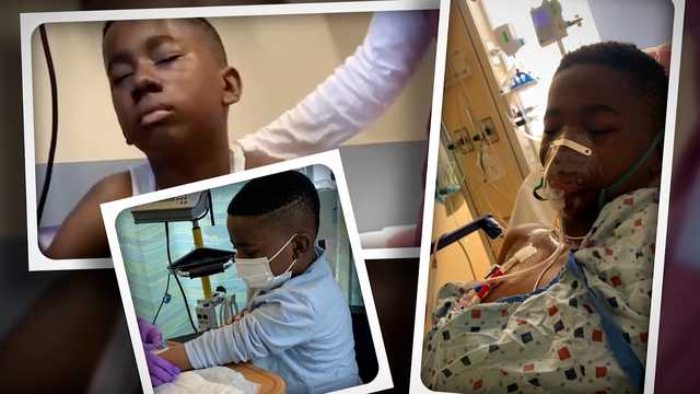 FDA approves treatment to help those with sickle cell disease - Vimarsana News
