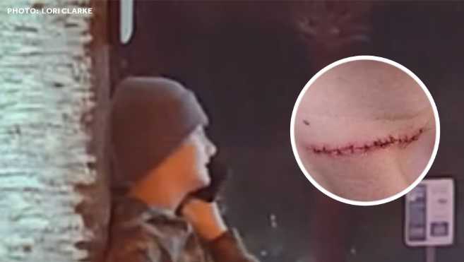 Violent, unprovoked attacks reported at 2 Florida beaches