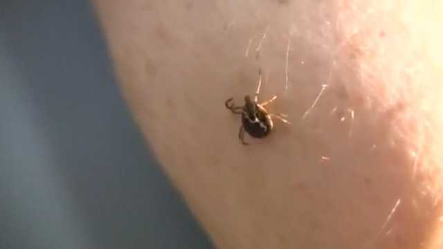 Hopkins doctors warn about Lyme disease dangers, offer tips - Vimarsana News