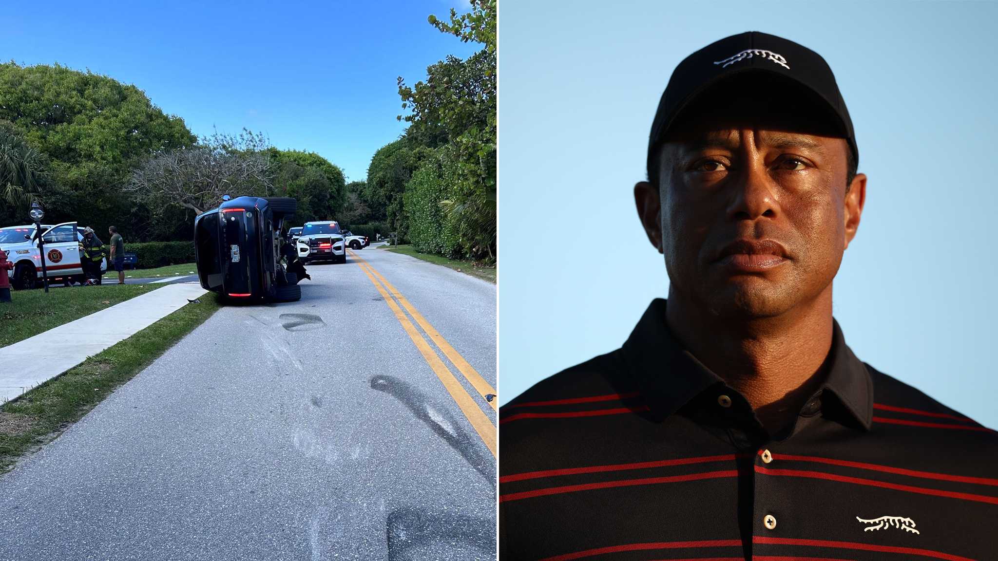 Expert says Tiger Woods’ medical history, 0.00 test could unravel DUI case after Florida rollover crash