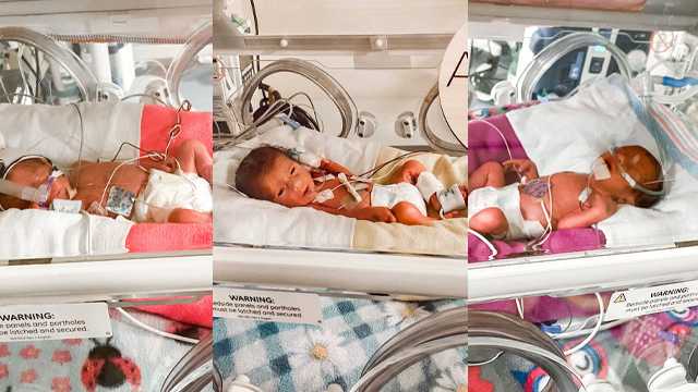 Rare Identical Triplets Oklahoma Mother Gives Birth To Rare Identical Triplets