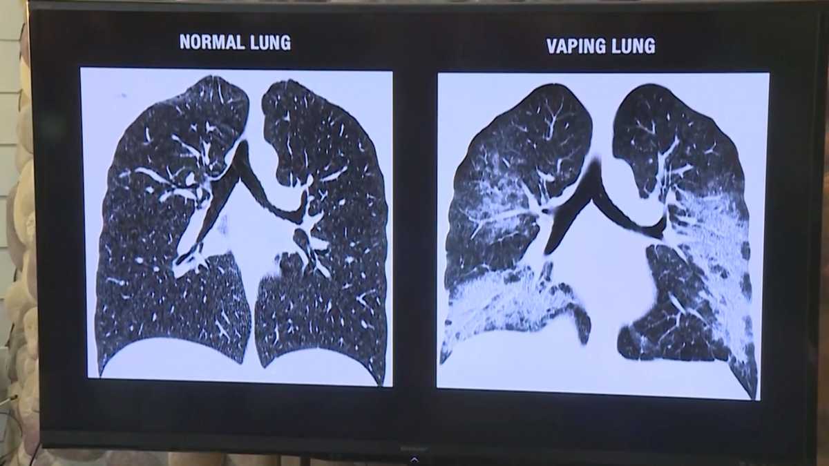 maine-doctors-health-officials-seeing-devastating-effects-of-vaping