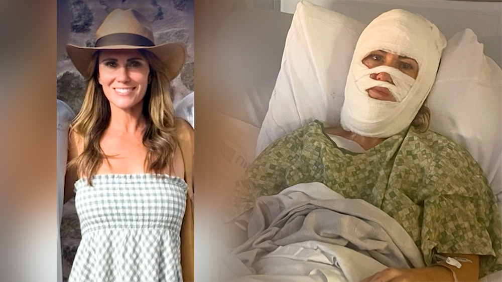 ‘Highly charged’ meeting held in Savannah acid attack case - WJCL