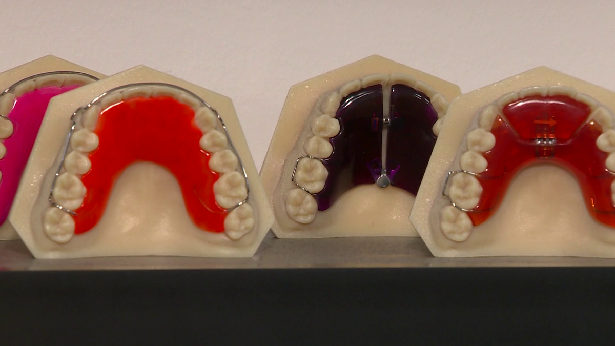 Dental appliance company NEOLAB manufacturing new smiles, changing lives