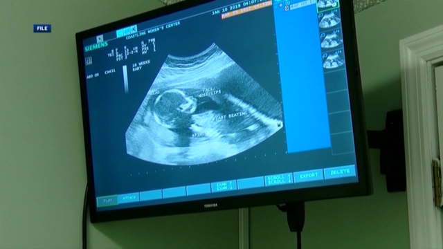 Report: Women lack access to maternity care in parts of GA, SC - Vimarsana News