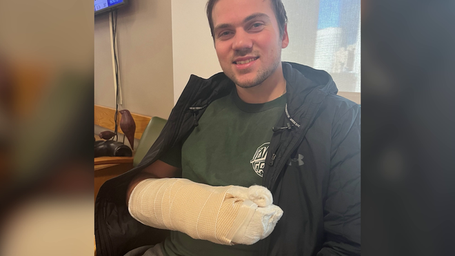Mass. doctor's second opinion, surgery helps save hockey player's hand