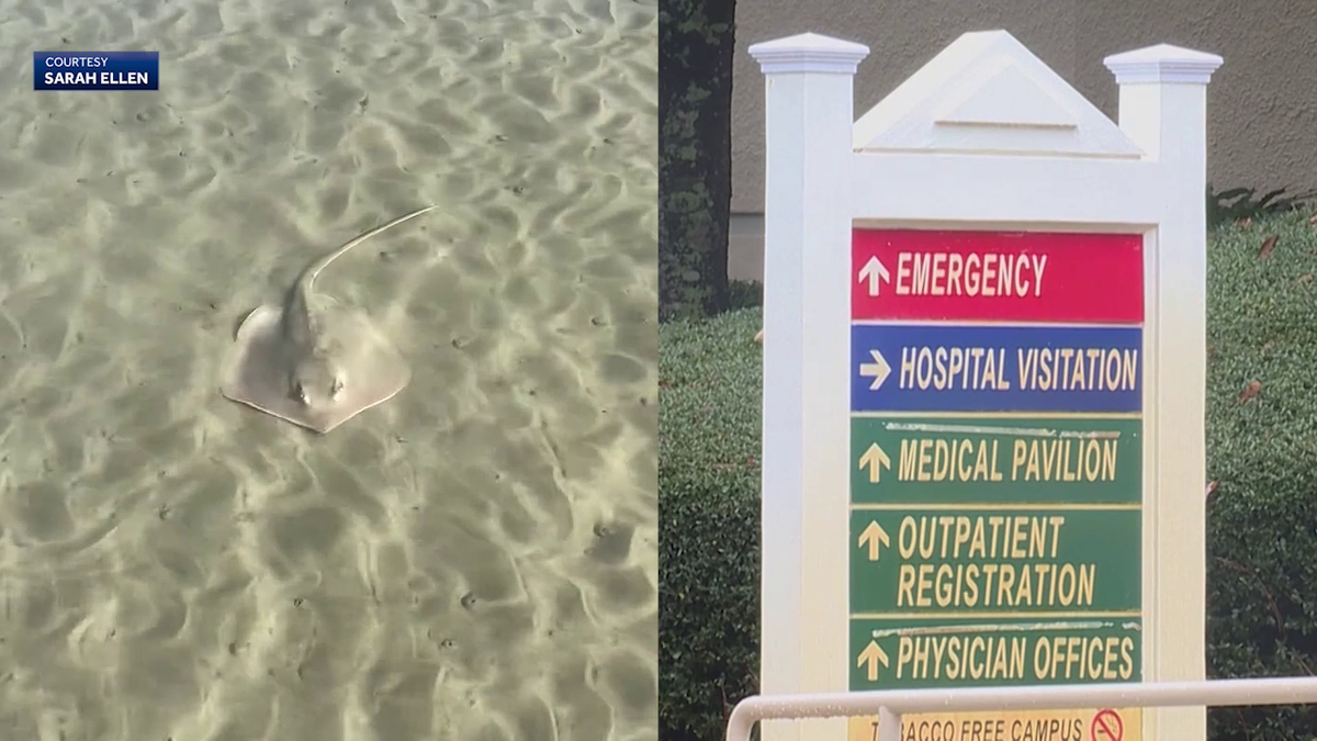 Hilton Head Hospital sees 3 stingray patients within one hour