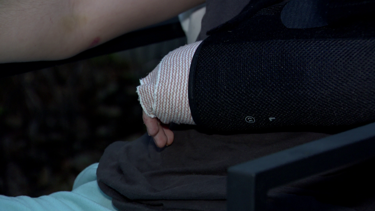 Winter Springs teen recovering after Facebook Marketplace sale gone wrong