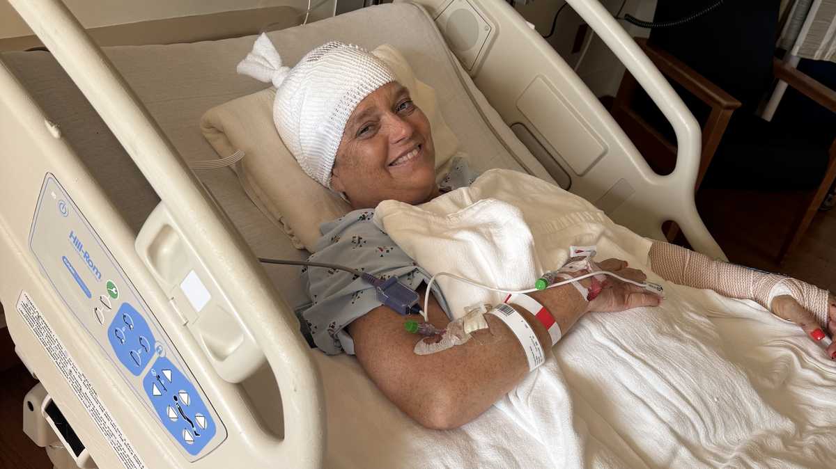 Volusia County woman recounts dog attack