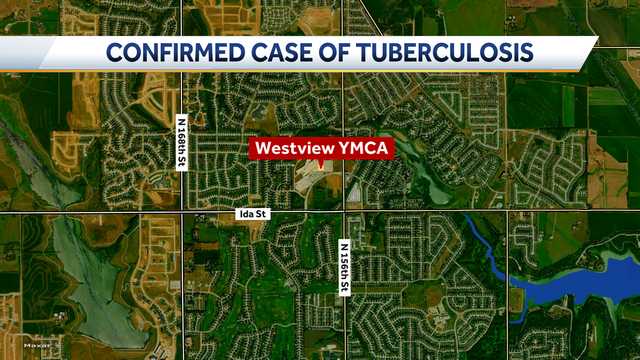 Douglas County confirms positive case of tuberculosis disease at local YMCA - Vimarsana News