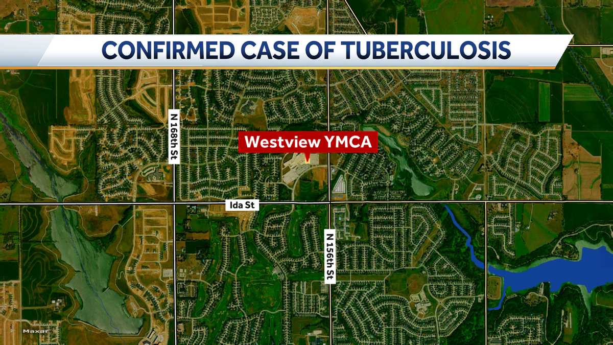 Douglas County confirms positive case of tuberculosis disease at local YMCA