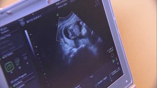 S.C. Senate passes bill that bans most abortions after six weeks - Vimarsana News