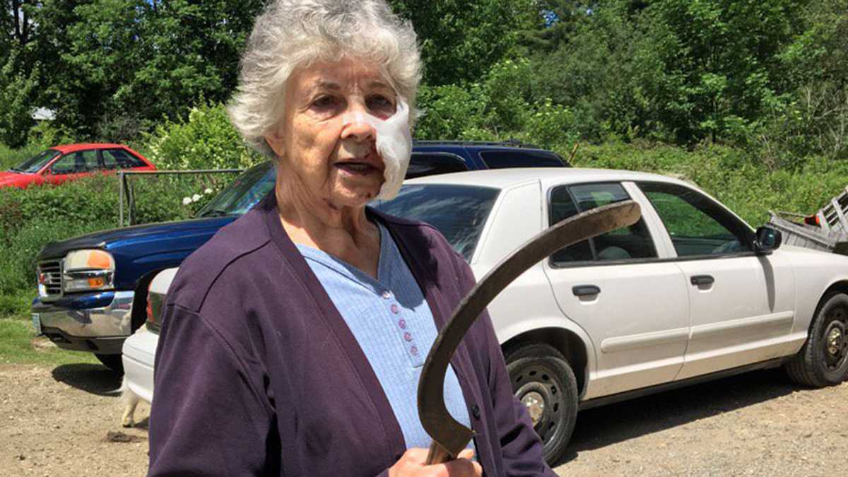 80 Year Old Woman Attacked By Rabid Bobcat While Gardening Outside Home
