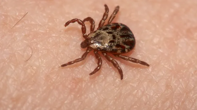 Georgia woman allergic to meat, dairy, soap following tick bite - Vimarsana News