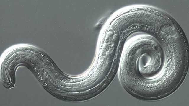 Brain parasite found in Georgia, what you need to look out for - Vimarsana News