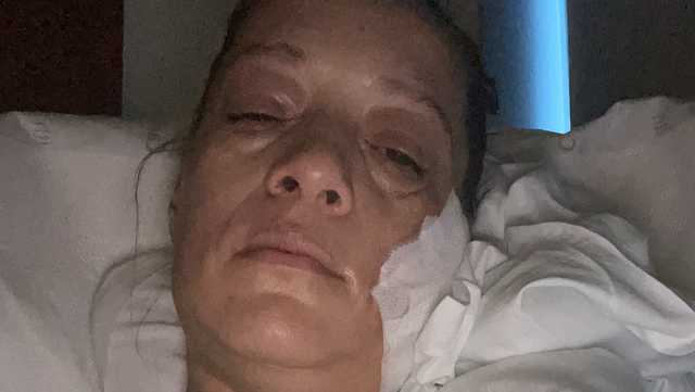 Milwaukee woman recovering after being hit in the face by stray bullets - Vimarsana News