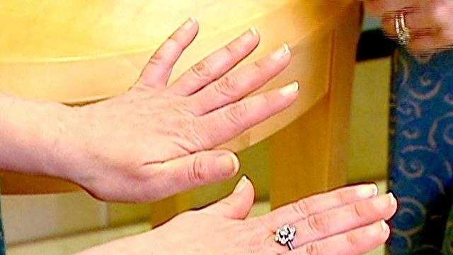 Woman's Doctor: What fingernails can signal about your health - Vimarsana News