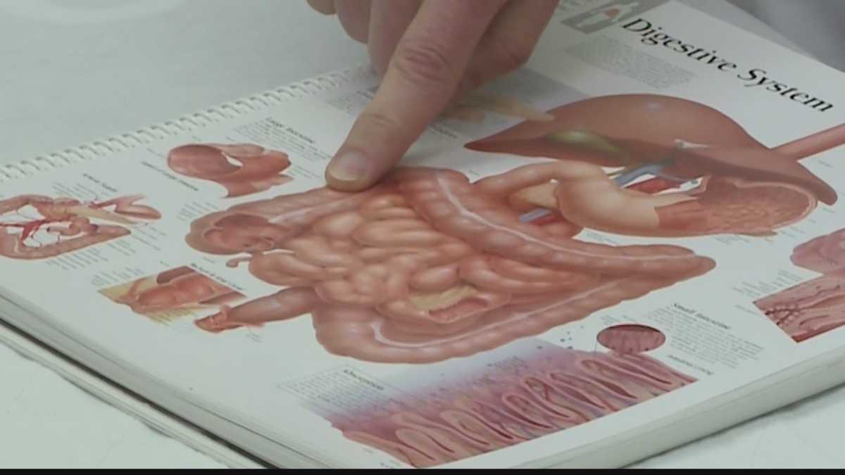 Milwaukee surgeon sees rise in colorectal cancer cases affecting young adults