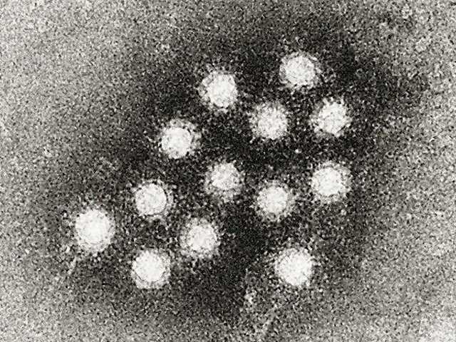 CDC Warns Of Potential Hepatitis A Exposure At Marco's In Lewiston