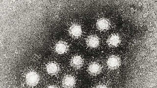 CDC brīdina par iespējamu A hepatīta iedarbību Marco’s Luistonā