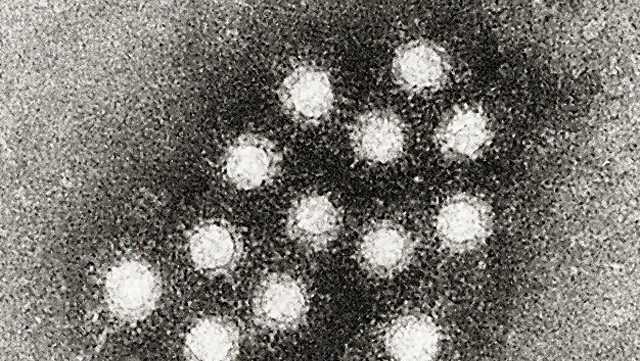 CDC brīdina par iespējamu A hepatīta iedarbību Marco’s Luistonā