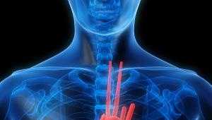 Doctor Discusses Heart Attack Symptoms Unrelated to Chest Pain - Vimarsana News