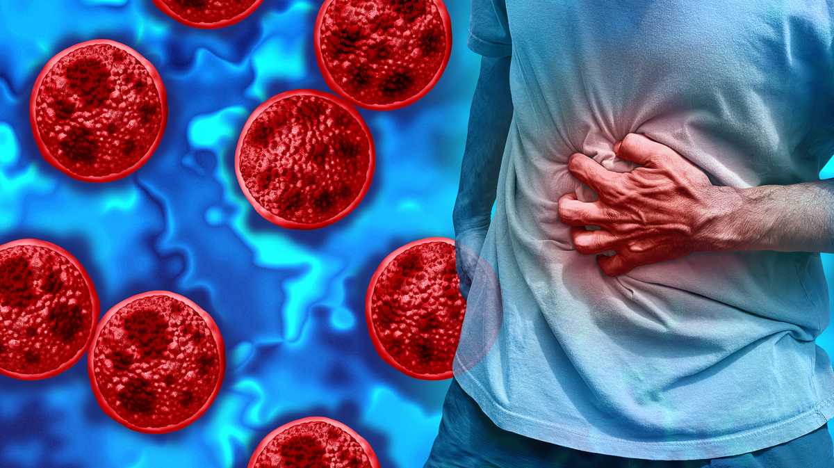 Map: 2 deaths, more than 22,000 cases of cyclospora reported across U.S.