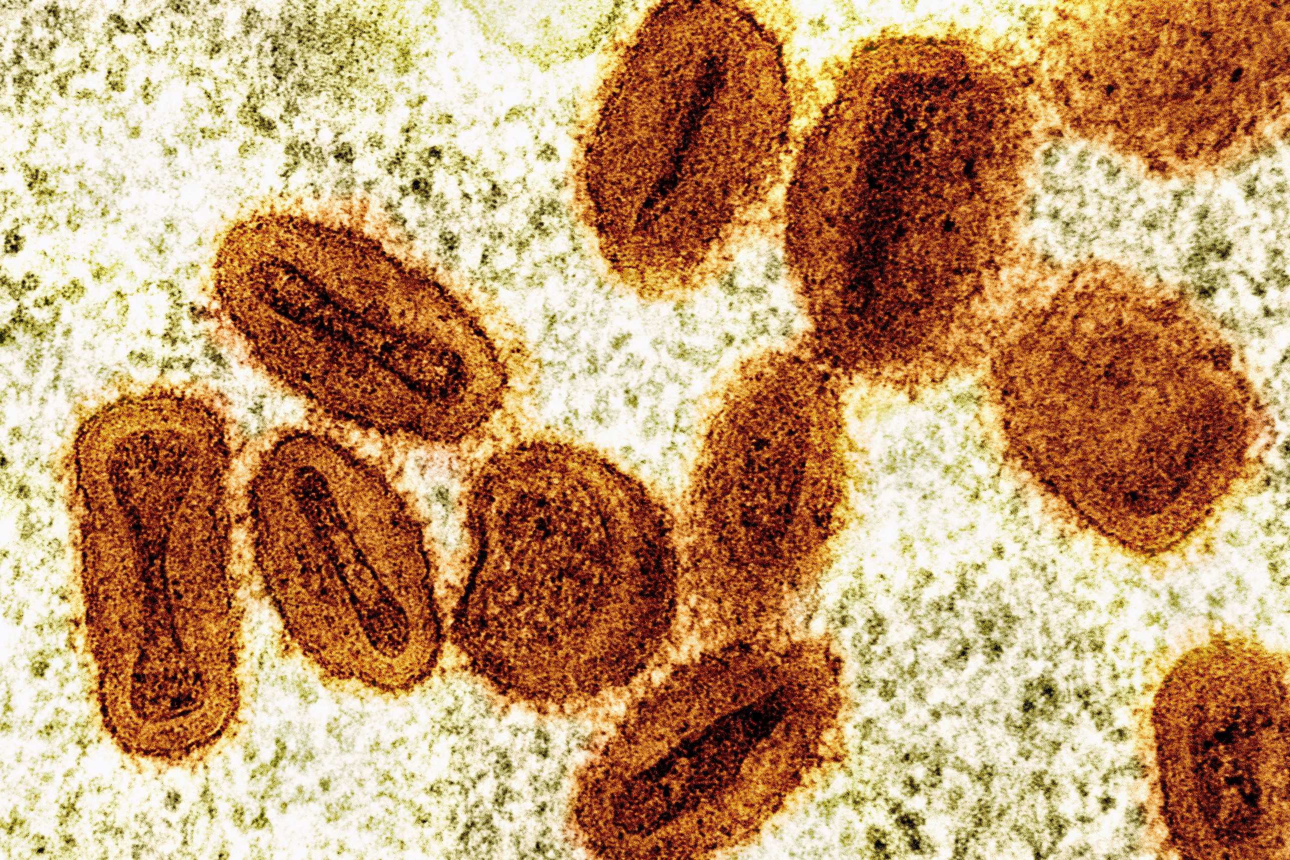 2 scientists charged with bringing deactivated mpox virus into the US