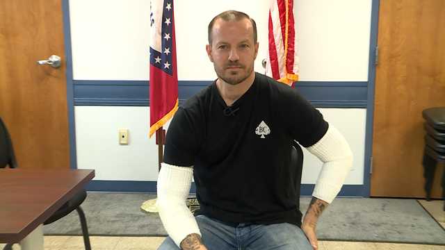 Crawford County deputy burned during fire rescue says he would do it again