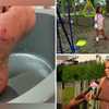 Fox that bit woman, child in Worcester had rabies, health officials confirm