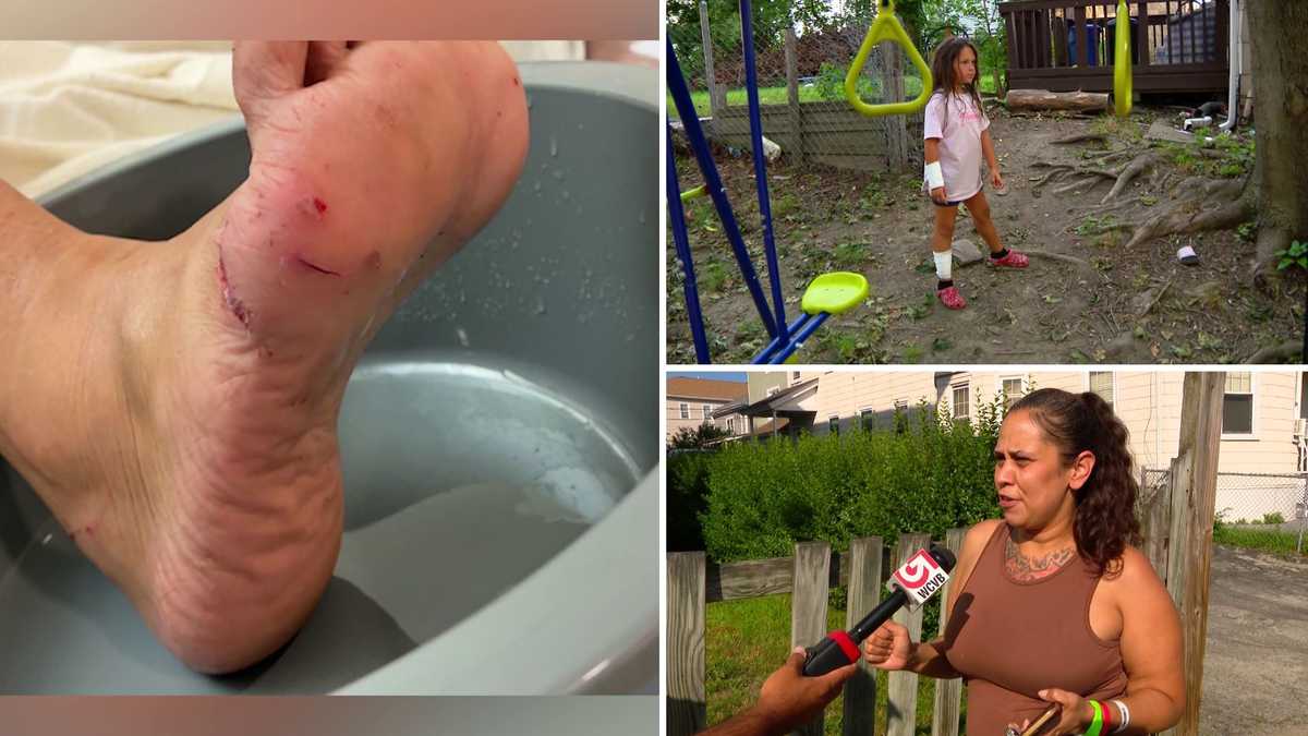 old girl, woman, bit by fox in Worcester, officials say